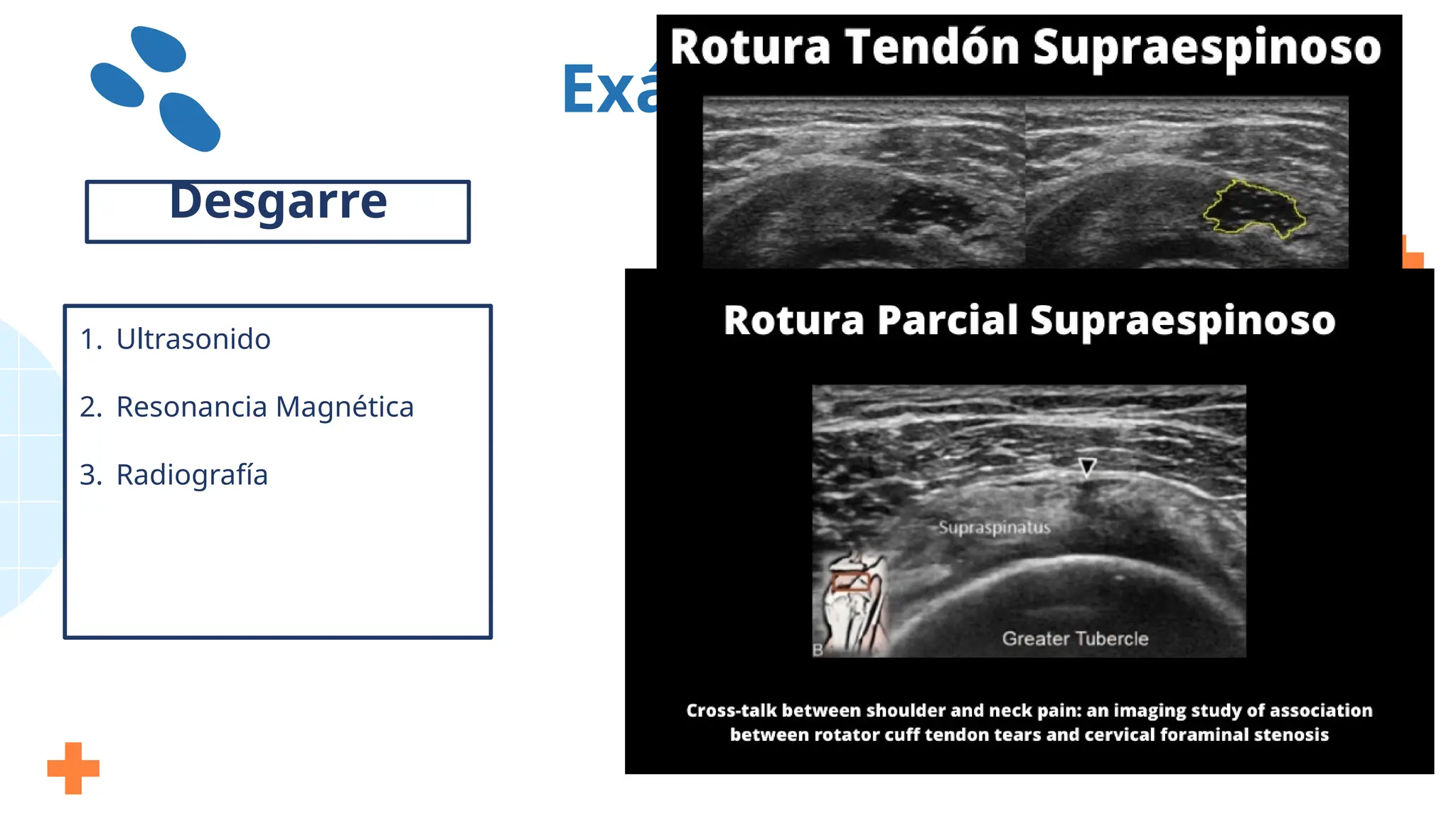 Exámenes
1. Ultrasonido
2. Resonancia Magnética
3. Radiografía
Desgarre
 