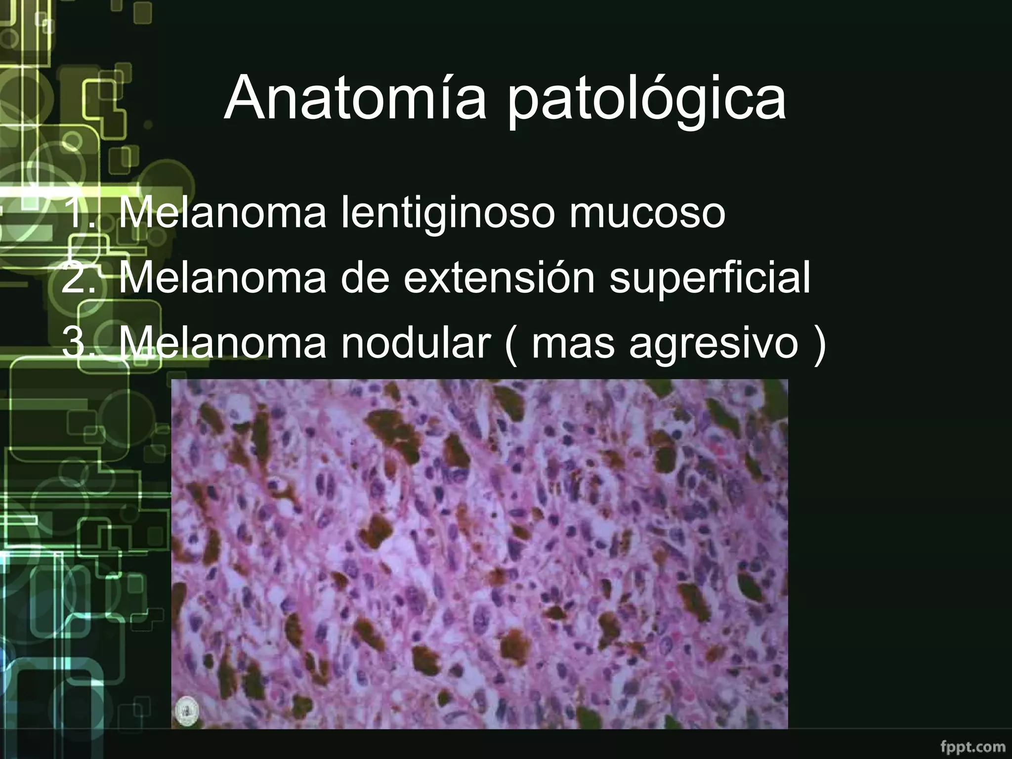Anatomía patológica
1. Melanoma lentiginoso mucoso
2. Melanoma de extensión superficial
3. Melanoma nodular ( mas agresivo )
 