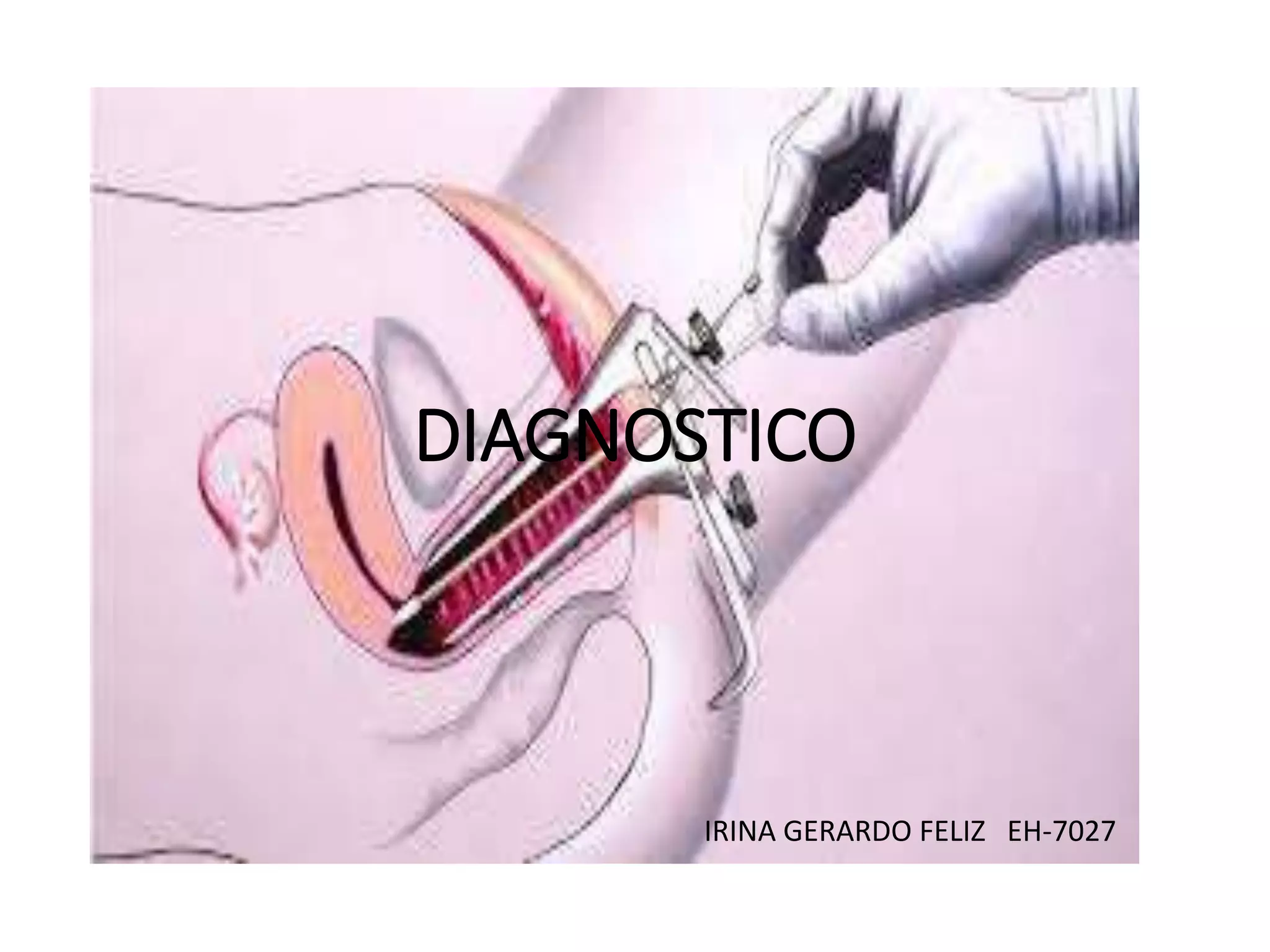 DIAGNOSTICO
IRINA GERARDO FELIZ EH-7027
 