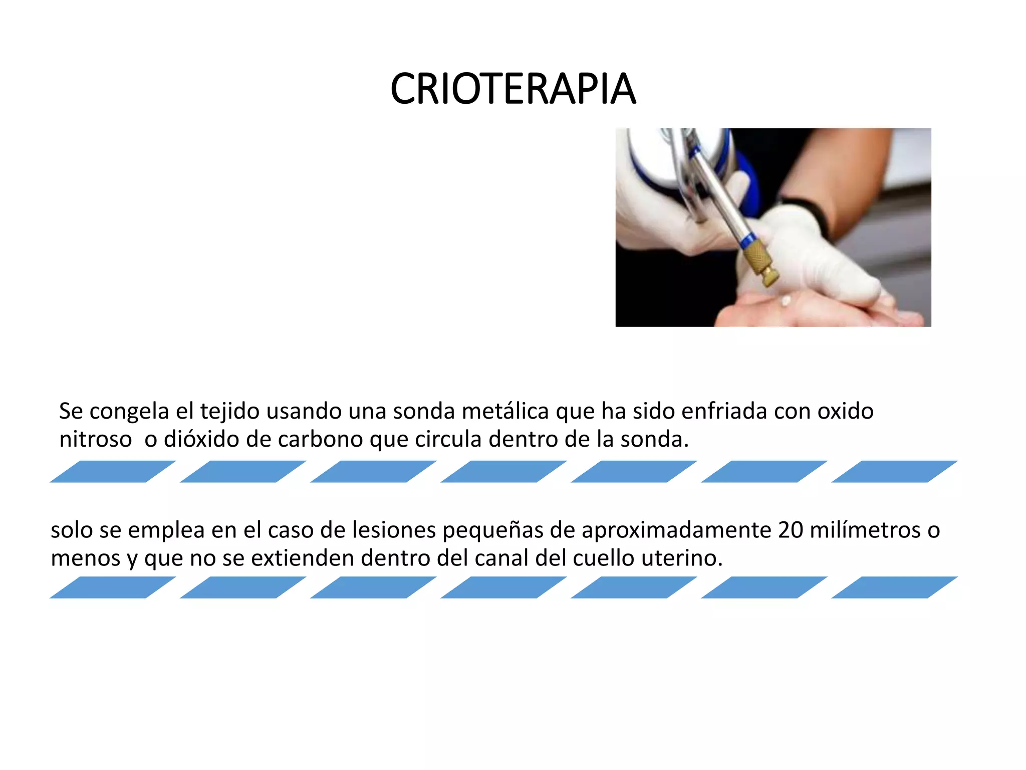 CRIOTERAPIA
Se congela el tejido usando una sonda metálica que ha sido enfriada con oxido
nitroso o dióxido de carbono que circula dentro de la sonda.
solo se emplea en el caso de lesiones pequeñas de aproximadamente 20 milímetros o
menos y que no se extienden dentro del canal del cuello uterino.
 