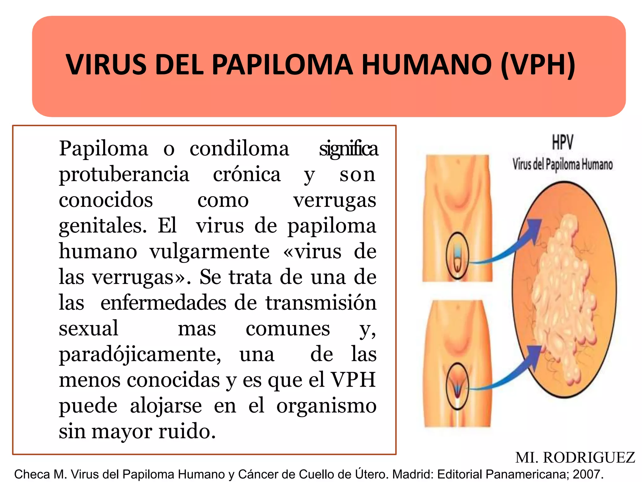 Papiloma o condiloma significa
protuberancia crónica y son
conocidos como verrugas
genitales. El virus de papiloma
humano vulgarmente «virus de
las verrugas». Se trata de una de
las enfermedades de transmisión
sexual mas comunes y,
paradójicamente, una de las
menos conocidas y es que el VPH
puede alojarse en el organismo
sin mayor ruido.
VIRUS DEL PAPILOMA HUMANO (VPH)
Checa M. Virus del Papiloma Humano y Cáncer de Cuello de Útero. Madrid: Editorial Panamericana; 2007.
MI. RODRIGUEZ
 