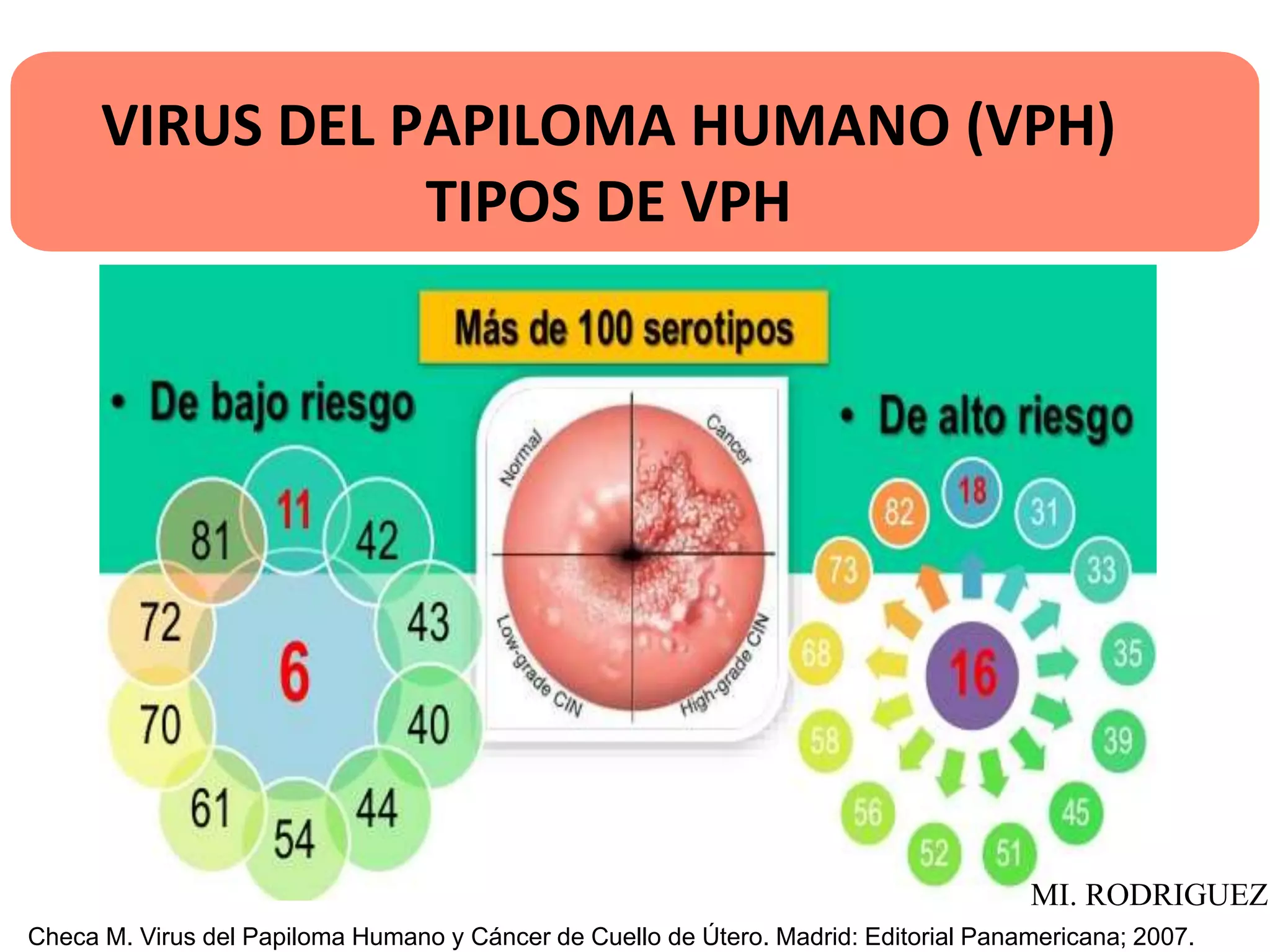 VIRUS DEL PAPILOMA HUMANO (VPH)
TIPOS DE VPH
Checa M. Virus del Papiloma Humano y Cáncer de Cuello de Útero. Madrid: Editorial Panamericana; 2007.
MI. RODRIGUEZ
 