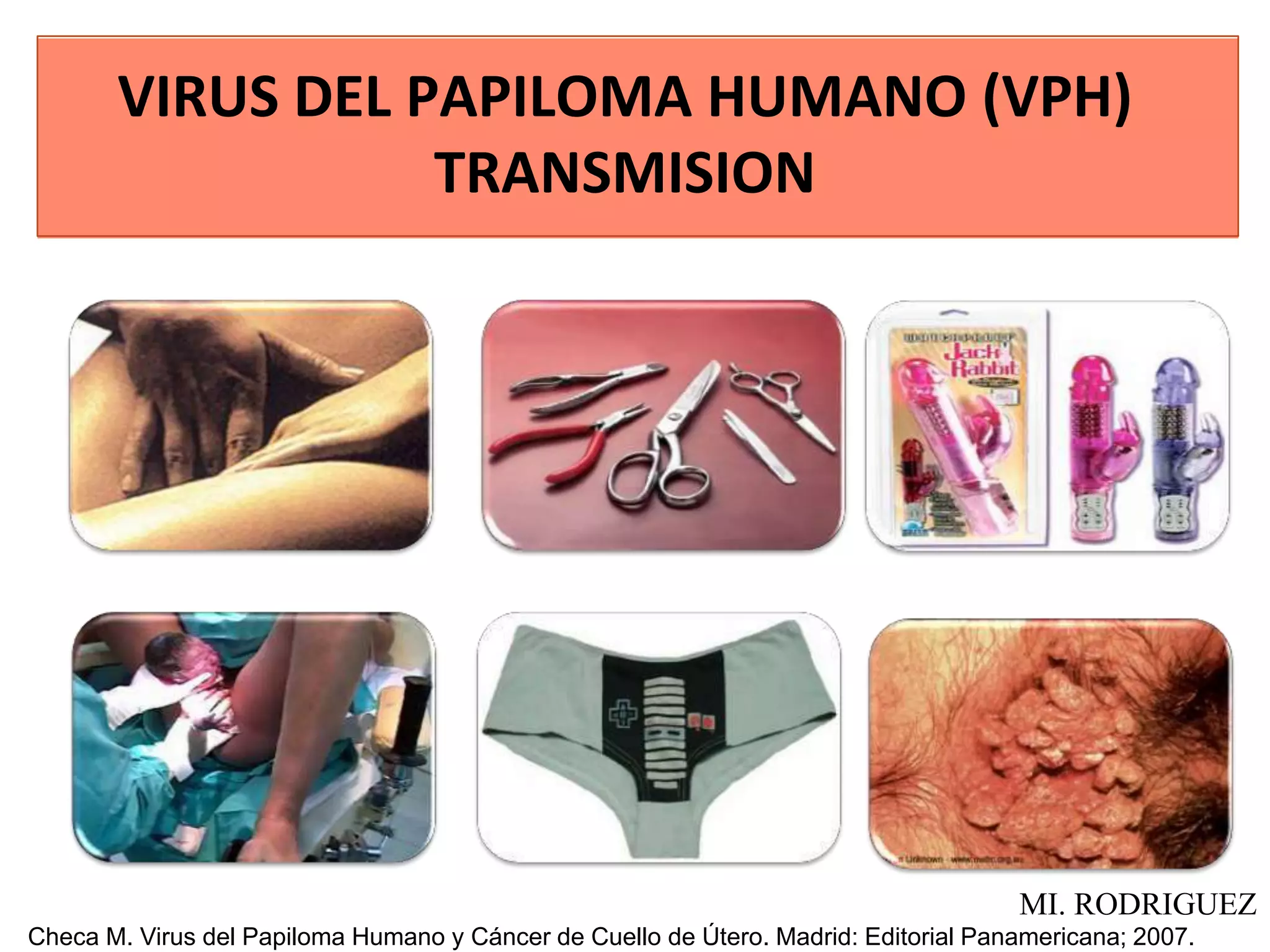 VIRUS DEL PAPILOMA HUMANO (VPH)
TRANSMISION
Checa M. Virus del Papiloma Humano y Cáncer de Cuello de Útero. Madrid: Editorial Panamericana; 2007.
MI. RODRIGUEZ
 