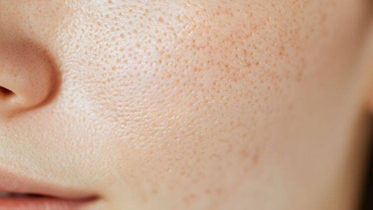 スキンケアより重要?毛穴がじわじわ広がる“NG食習慣”とは|管理栄養士が解説