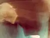 You Might Also Like thumb-123257533