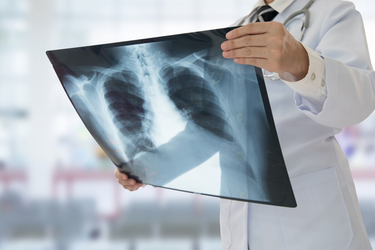Actuellement, il n’y a un dépistage que pour le cancer du col de l’utérus, le cancer du sein et le cancer colorectal, pas le cancer du poumon.
